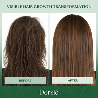 Dersie Batana Oil Conditioner